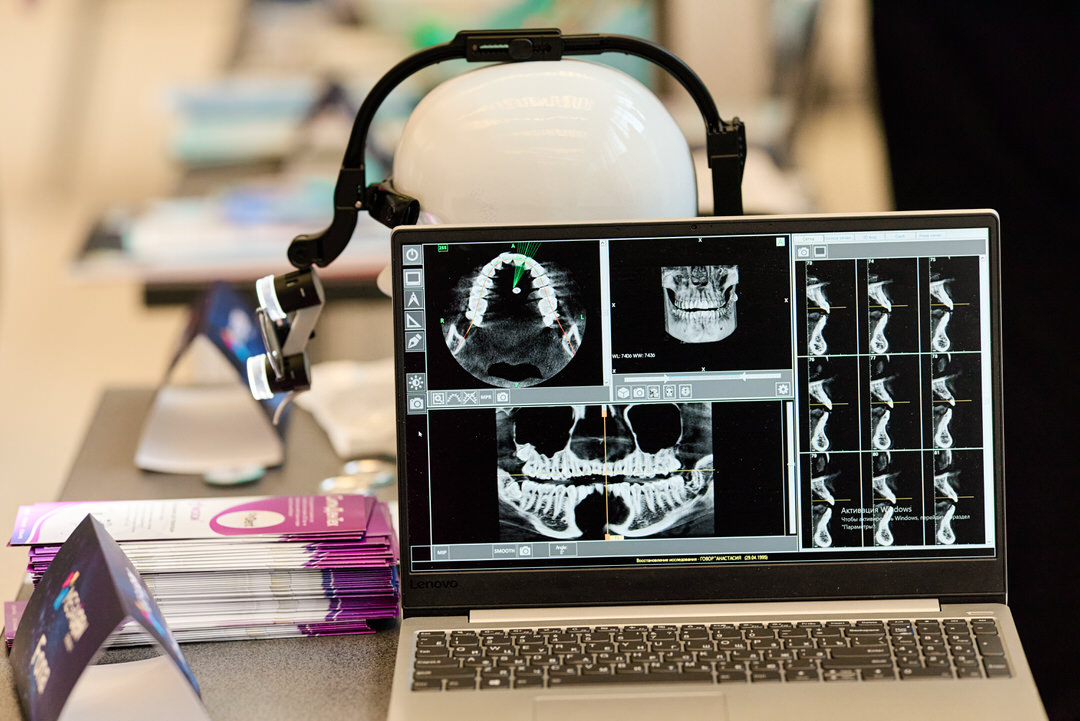 Фотограф мероприятий Гомель ОКЦ Ланге 17, конференция MegaGen 130321 фото 50